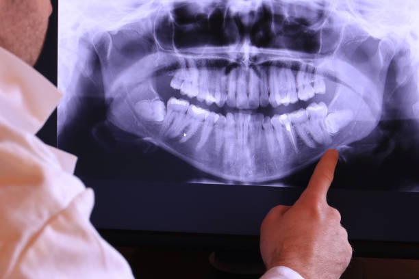 Best Emergency Root Canal Treatment in Chestertown, MD