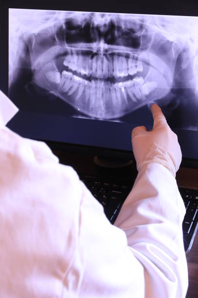 Best Emergency Dental Care for Abscessed Tooth in Chestertown, MD