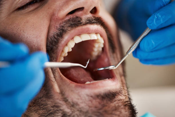 Best Pediatric Emergency Dentist in Chestertown, MD